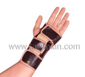 سندروم تونل کارپال (Carpal Tunnel Syndrome) اختلال فشاری عصب مدیان در مچ دست