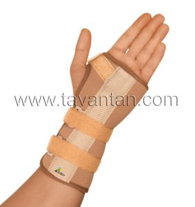 سندروم تونل کارپال (Carpal Tunnel Syndrome) اختلال فشاری عصب مدیان در مچ دست
