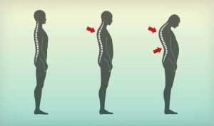 قوزبند برای پشت صاف