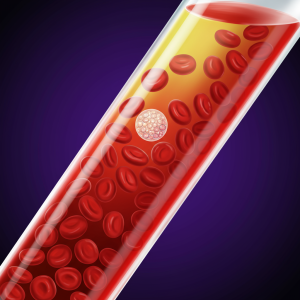 تاثیر غلظت خون بر درد مفاصل بدن