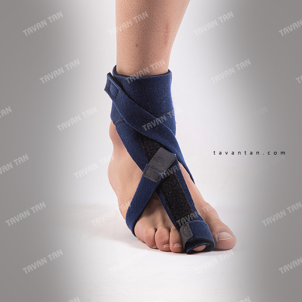 آتل انگشت دست و پا