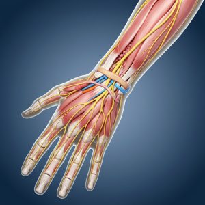 بی‌حسی و گزگز دست‌ها؛ مشکل از گردن است یا مچ دست؟